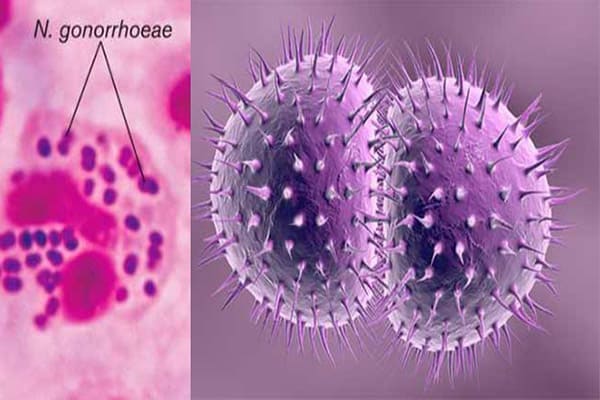 Hình ảnh song cầu khuẩn lậu (có tên là Neisseria gonorrhoeae) gây bệnh lậu