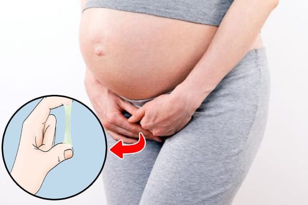 Có nhiều nguyên nhân gây nên tình trạng huyết trắng ra nhiều khi mang thai