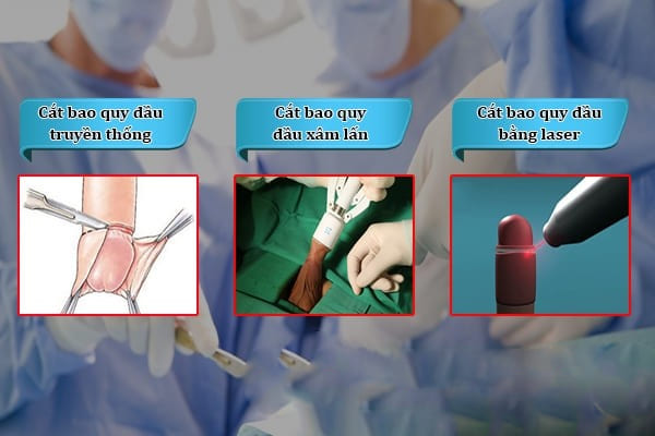 Các cách chữa dài bao quy đầu hiệu quả cho nam giới tại Phòng Khám Việt Hải