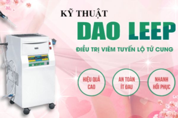 Dao Leep là phương pháp điều trị viêm lộ tuyến cổ tử cung hiệu quả