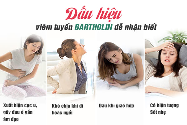 Dấu hiệu viêm nang tuyến bartholin ở nữ giới