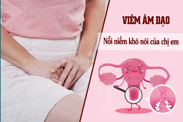 Viêm âm đạo - Căn bệnh thường gặp ở nữ giới