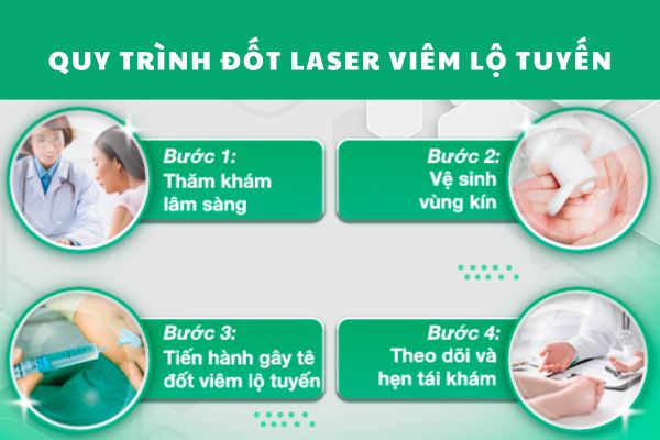 Quy trình đốt laser viêm lộ tuyến an toàn