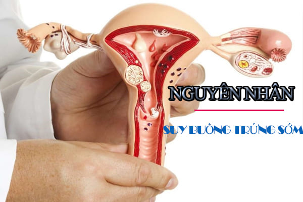 Nguyên nhân gây suy buồng trứng sớm ở nữ giới