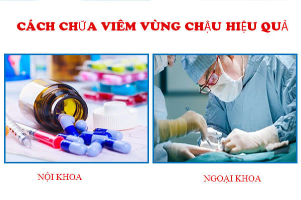 Chữa viêm vùng chậu an toàn, hiệu quả tại Phòng Khám Việt Hải