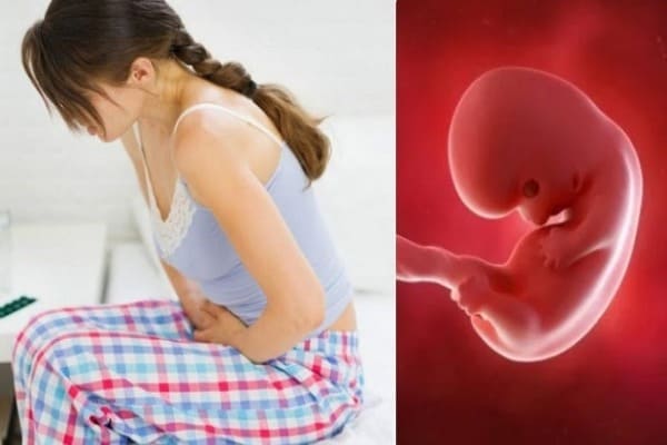 Có nhiều nguyên nhân dẫn đến tình trạng thai chết lưu 
