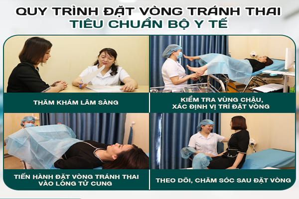 Quy trình tiến hành đặt vòng tránh thai đúng chuẩn tại Phòng Khám Việt Hải
