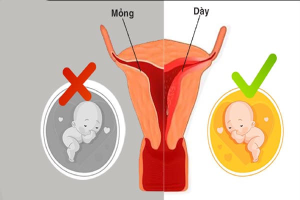 Niêm mạc tử cung mỏng ảnh hưởng đến khả năng mang thai như thế nào?
