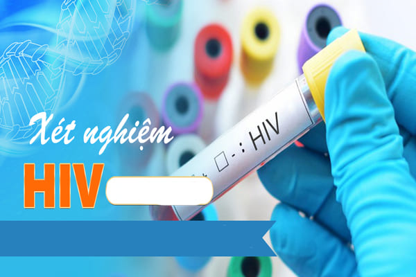 Thực hiện xét nghiệm HIV uy tín, kết quả nhanh tại Phòng Khám Việt Hải
