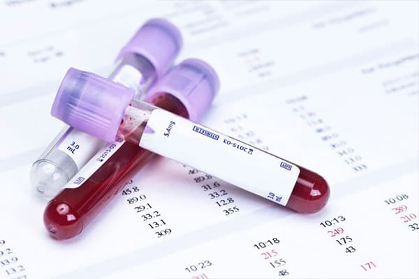  Xét nghiệm máu một loại hình xét nghiệm HPV được áp dụng phổ biến hiện nay